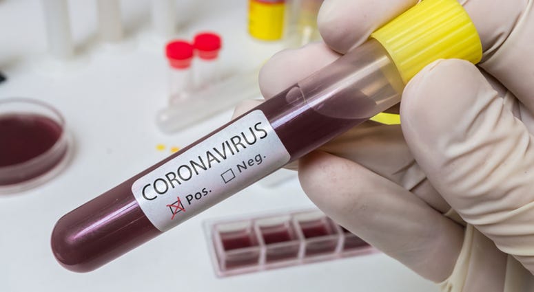 Coronavirus 2019-nCOV analysis Coronavirus 2019-nCOV analysis