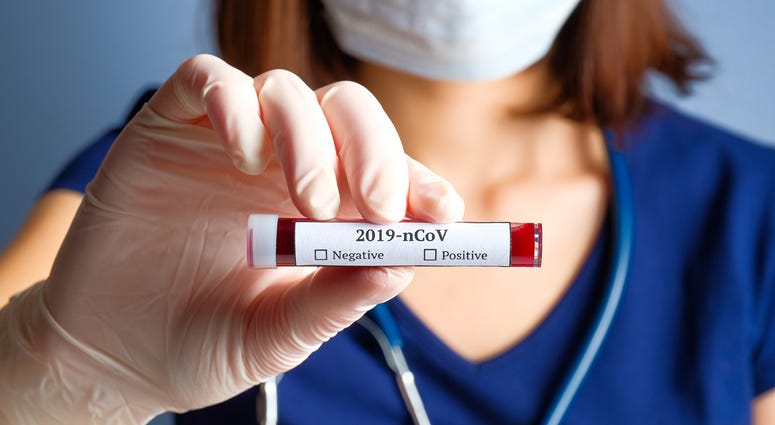Nurse holding test tube with blood for 2019-nCoV analyzing Nurse holding test tube with blood for 2019-nCoV analyzing