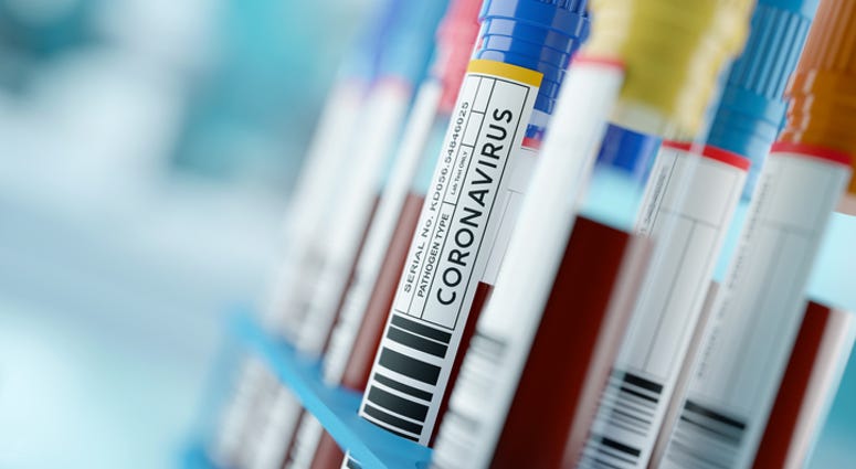 coronavirus test, hospital lab coronavirus, hospital lab