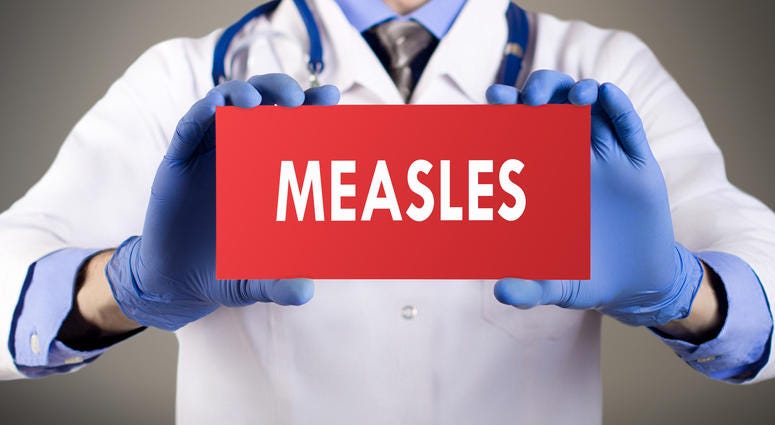 Measles Measles