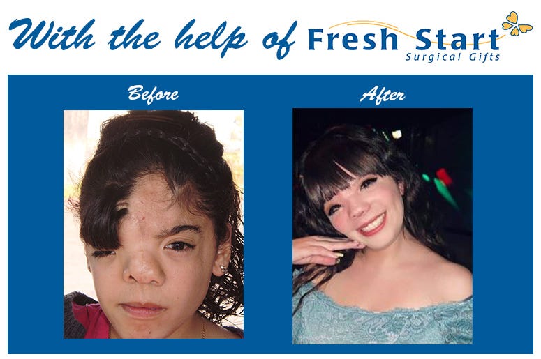Fresh Start Radiothon