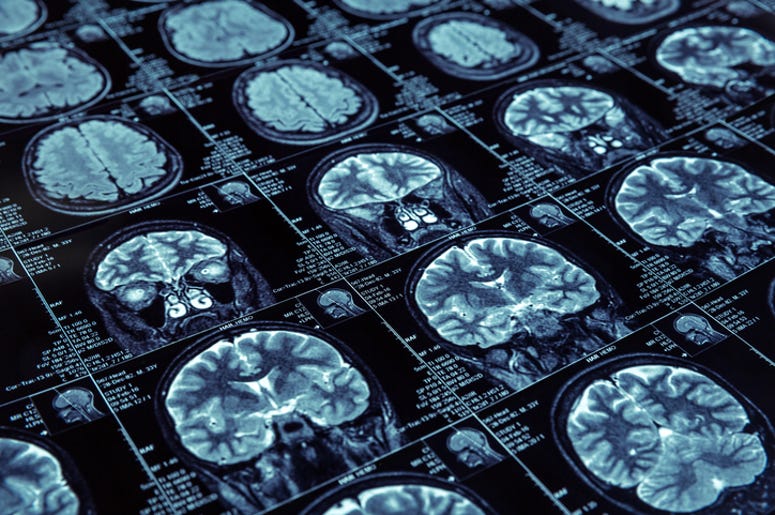 Brain scans Brain scans