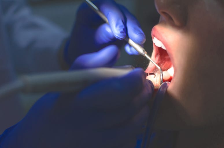 Dentist, Teeth, Cleaning, Stone Removal Procedure Dentist, Teeth, Cleaning, Stone Removal Procedure