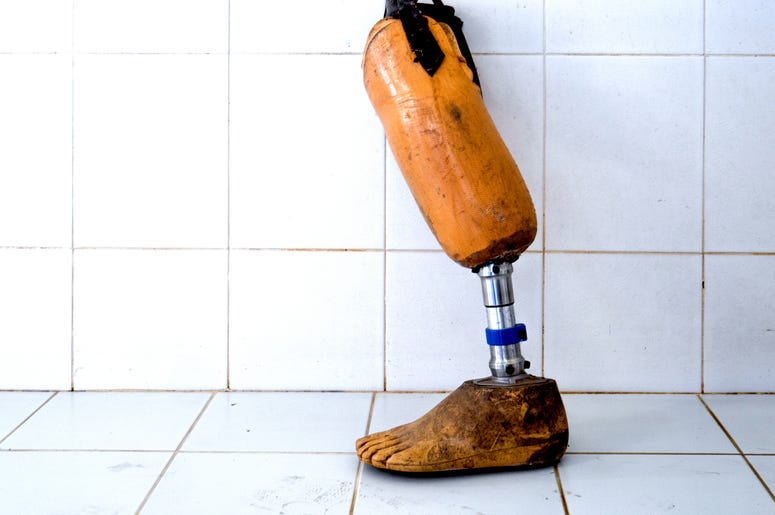 (angkhan/ iStock Getty) prosthetic leg
