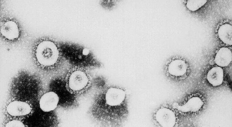 Microscope shot of Coronavirus