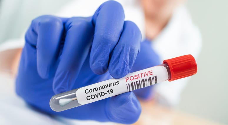Coronavirus Infected Swab Test Sample in Doctor Hands. COVID-19 Epidemic and Virus Outbreak.