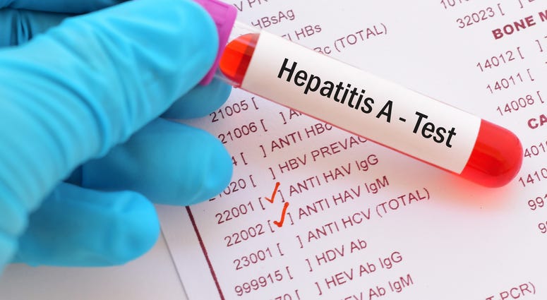 Blood sample for hepatitis A virus (HAV) test