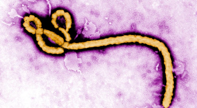 This undated colorized transmission electron micrograph image made available by the Centers for Disease Control and Prevention shows an Ebola virion. This undated colorized transmission electron micrograph image made available by the Centers for Disease Control and Prevention shows an Ebola virion.