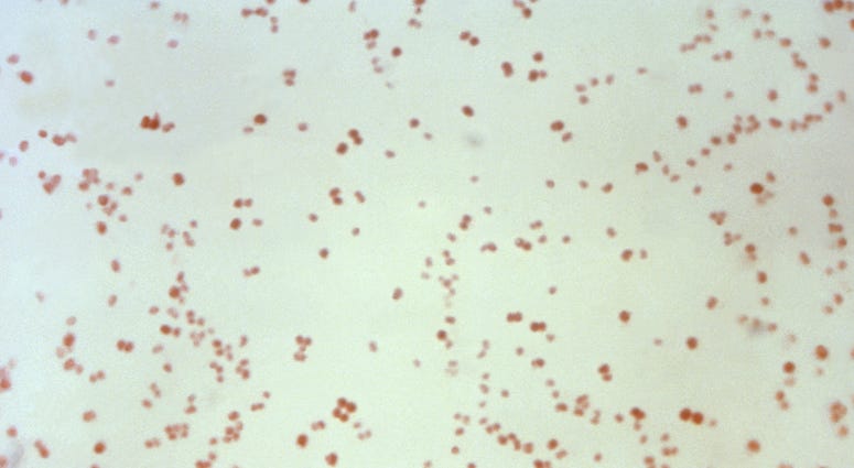 This 1971 microscope image shows Neisseria gonorrhoeae bacteria, which causes the sexually transmitted disease gonorrhea. Neisseria gonorrhoeae bacteria, which causes the sexually transmitted disease gonorrhea