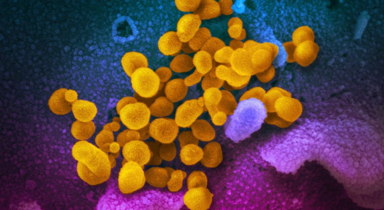 Electron microscope image shows the Novel Coronavirus SARS-CoV-2, yellow, emerging from the surface of cells, blue/pink, cultured in the lab. Electron microscope image shows the Novel Coronavirus SARS-CoV-2, yellow, emerging from the surface of cells, blue/pink, cultured in the lab.
