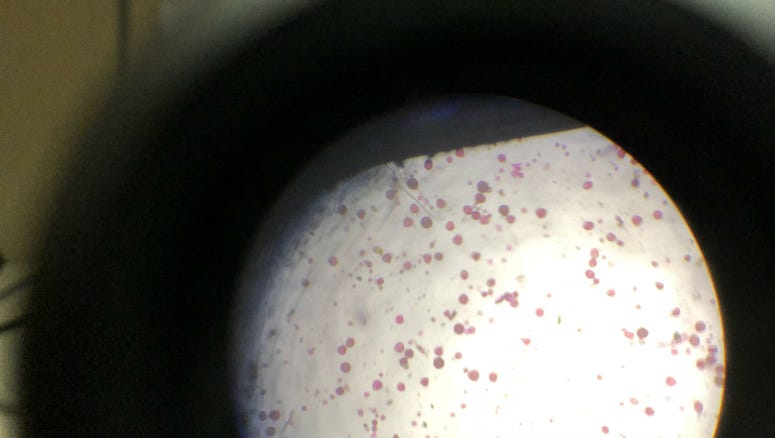 Pollen is seen through a microscope. Pollen is seen through a microscope.