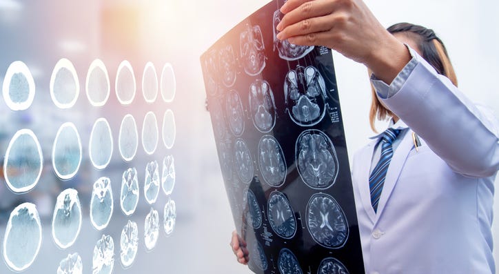 brain injury.