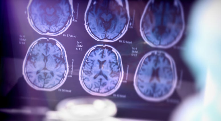 Brain scan.
