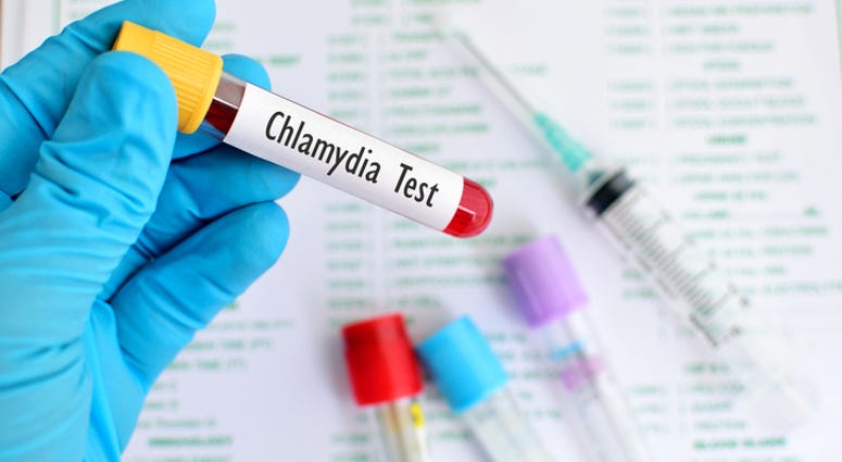 Chlamydia test. Chlamydia test.