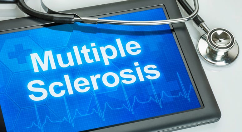 multiple sclerosis. multiple sclerosis.