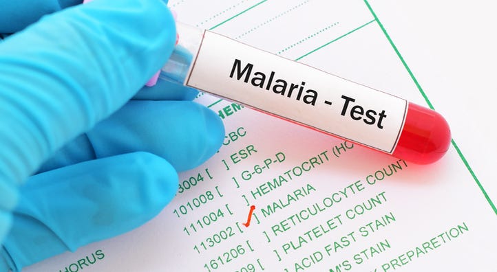 Malaria. Malaria test results.
