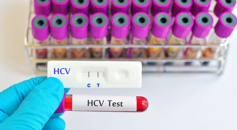Hepatitis C testing Hepatitis C testing