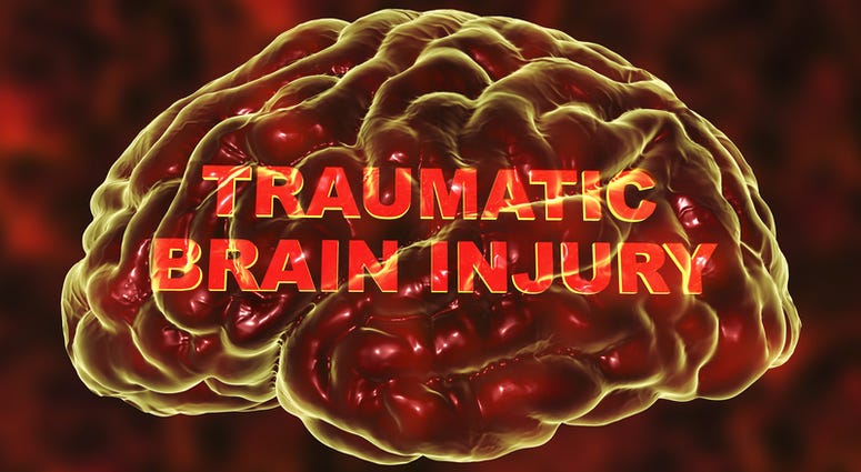 According to a new study, traumatic brain injury has been linked to a higher risk of suicide. Traumatic brain injury
