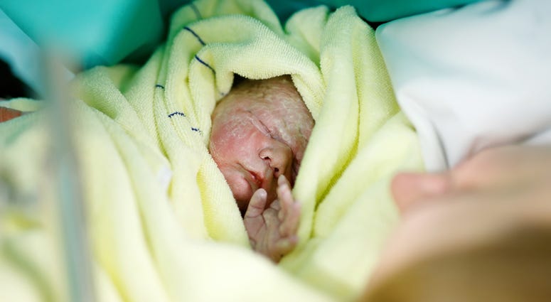 Newborn baby being born via Caesarean Section. Child Birth