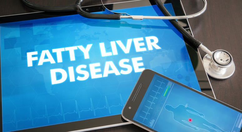 Nonalcoholic fatty liver disease is found in people as they get older, especially if they are obese. nonalcoholic fatty liver disease