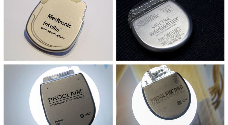 This combination of Aug. 25, 2018 photos shows demonstration models of implantable neurostimulators, top row from left, the Medtronic Intellis and the Boston Scientific Spectra WaveWriter SCS. This combination of Aug. 25, 2018 photos shows demonstration models of implantable neurostimulators, top row from left, the Medtronic Intellis and the Boston Scientific Spectra WaveWriter SCS.