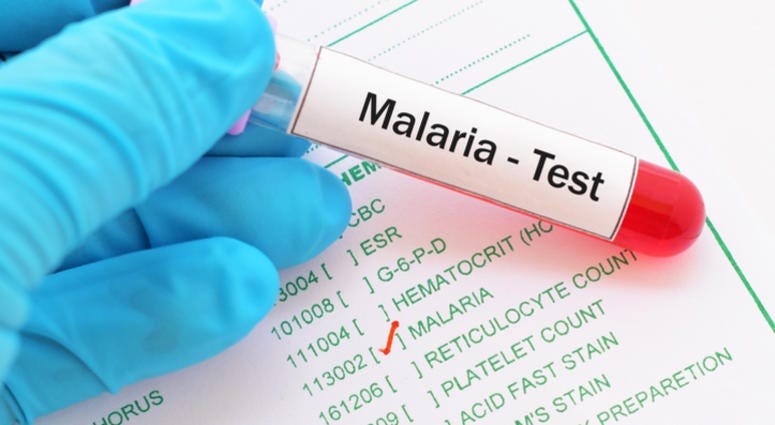 Malaria. Malaria test results.