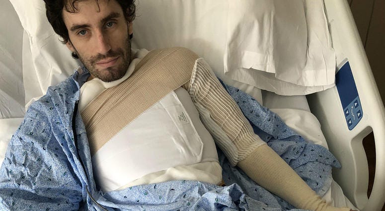 Ray Mullen has third-degree burns on 30 percent of his body Ray Mullen has third-degree burns on 30 percent of his body