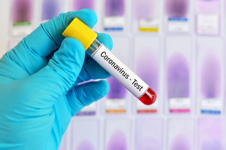 Coronavirus test