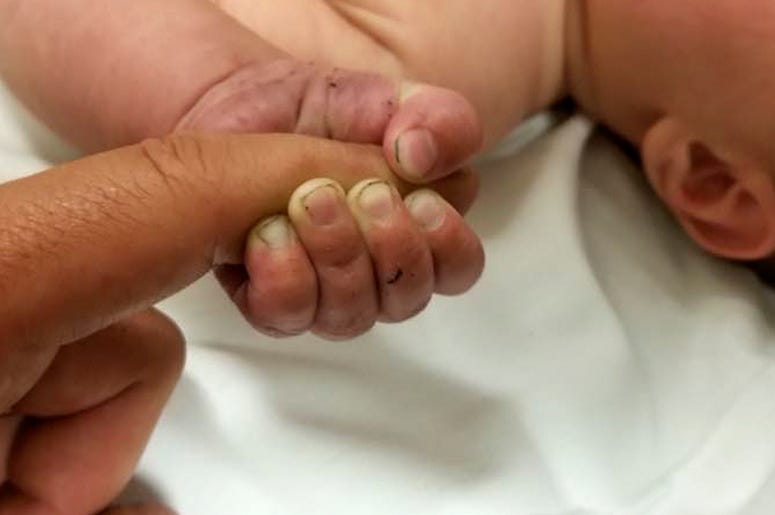 AP18190628230215 This Sunday, July 8, 2018 photo provided by the Missoula County Sheriff's Office shows a 5-month-old infant with dirt under their fingernails after authorities say the baby survived about nine hours being buried under sticks and debris in the woods. The M