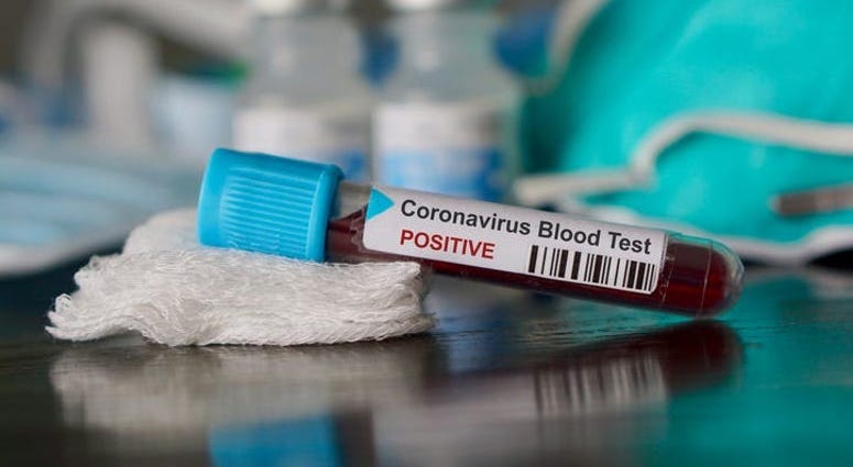 Coronavirus Blood Test Coronavirus Blood Test