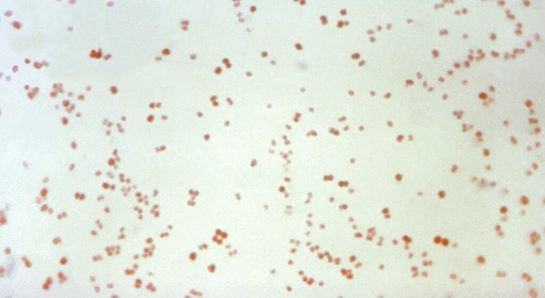 This 1971 microscope image made available by the Centers for Disease Control and Prevention shows Neisseria gonorrhoeae bacteria, which causes the sexually transmitted disease gonorrhea. This 1971 microscope image made available by the Centers for Disease Control and Prevention shows Neisseria gonorrhoeae bacteria, which causes the sexually transmitted disease gonorrhea.