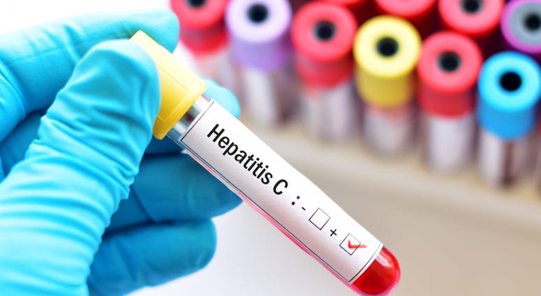 Hepatitis C Hepatitis C