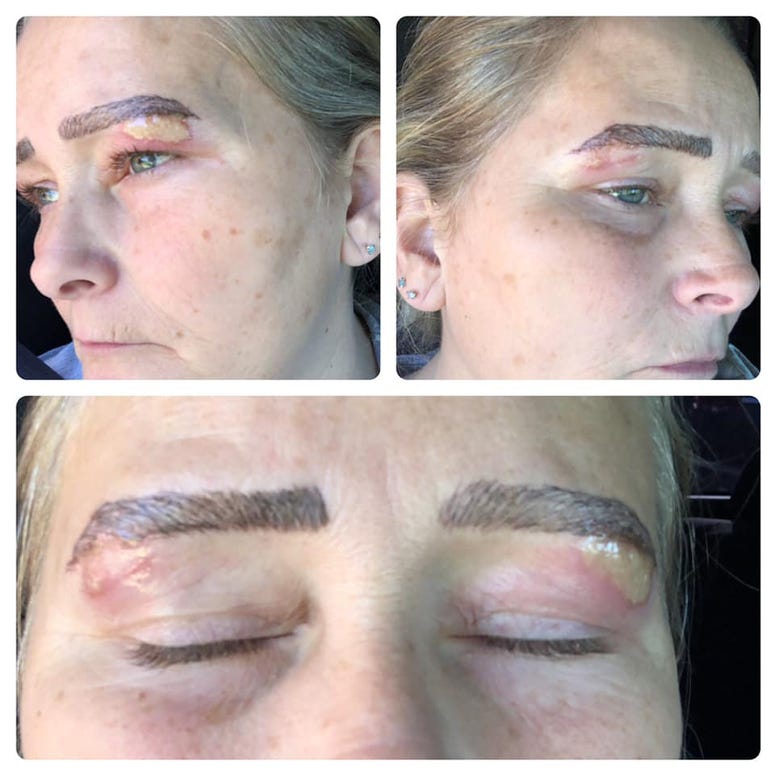 Eyebrows2