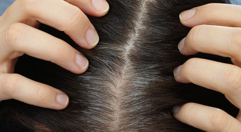 Gray Roots