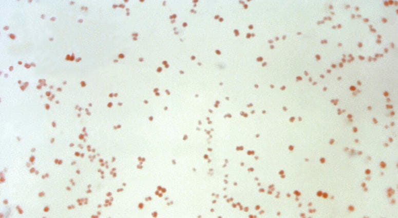 This 1971 microscope image made available by the Centers for Disease Control and Prevention shows Neisseria gonorrhoeae bacteria, which causes the sexually transmitted disease gonorrhea. This 1971 microscope image made available by the Centers for Disease Control and Prevention shows Neisseria gonorrhoeae bacteria, which causes the sexually transmitted disease gonorrhea.