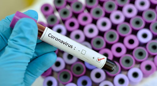 Coronavirus being tested in a lab