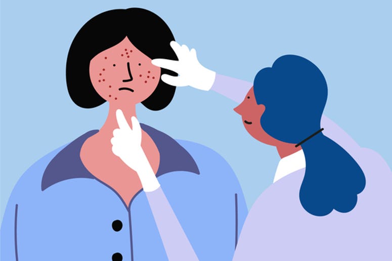 pimple popper