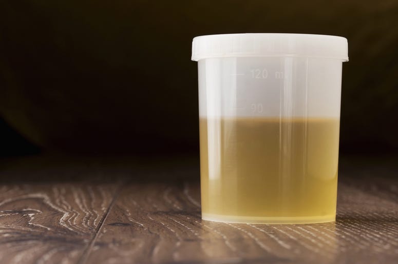 Jar of urine Jar of urine