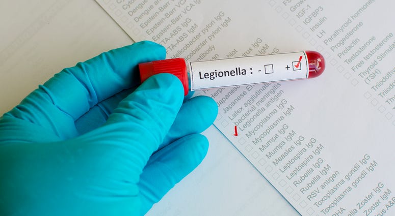 Blood sample with legionella positive Legionnaires’ Disease