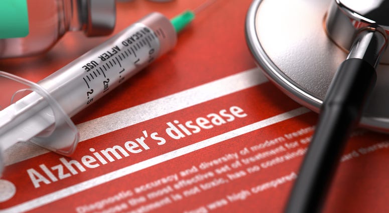 Diagnosis - Alzheimer's disease. Diagnosis - Alzheimer's disease.