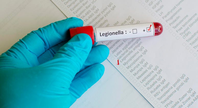 Blood sample with legionella positive Legionnaires’ Disease