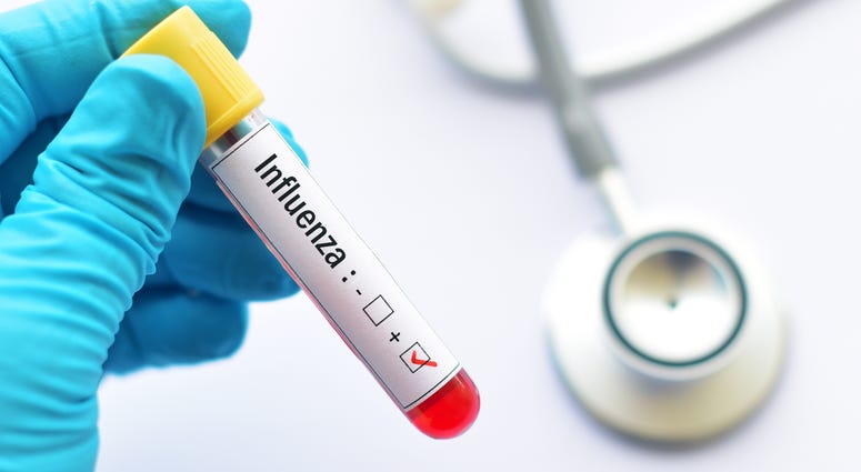 Flu Flu