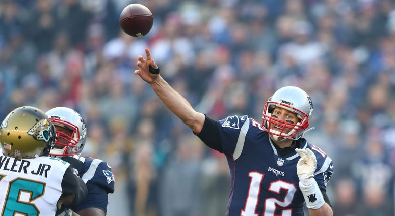 Brady looked just fine throwing the ball despite the hand injury he suffered this week. He had black tape on it. (USA Today Sports)