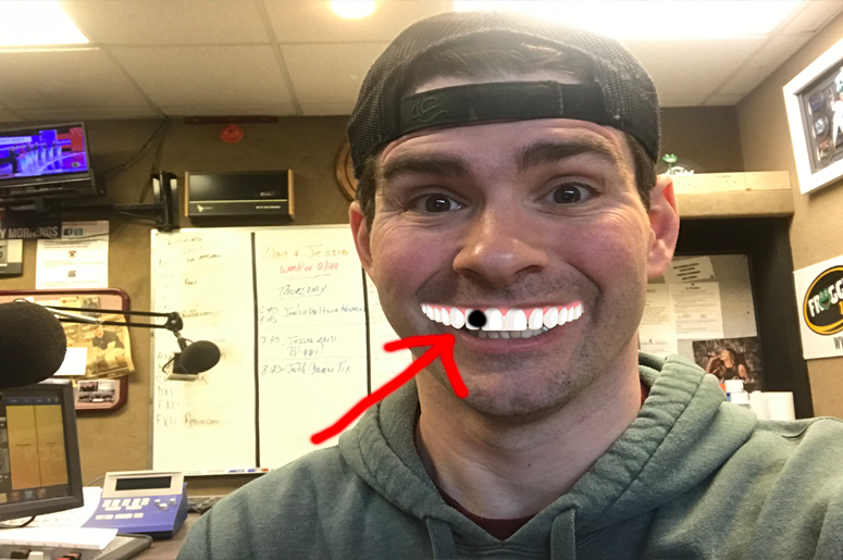 Poppy seeds in the teeth!