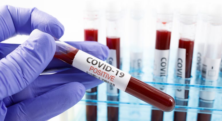 COVID-19 Positive Test