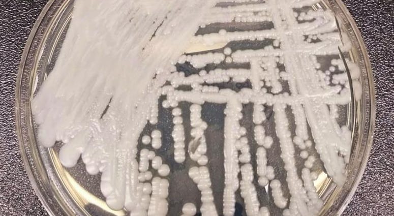 Candida Auris Candida Auris