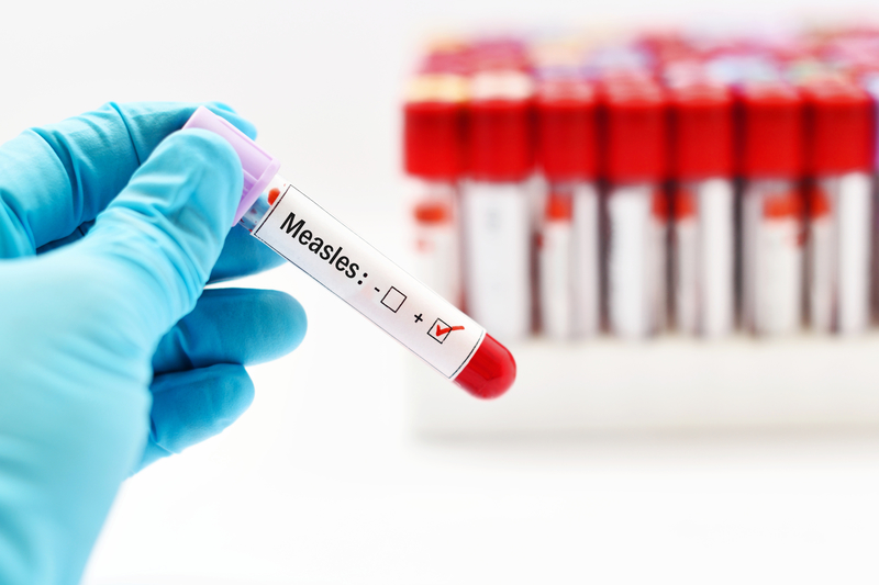 Measles vaccine Measles vaccine