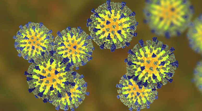 Measles Measles