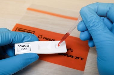 Covid-19 Anti-Body tests