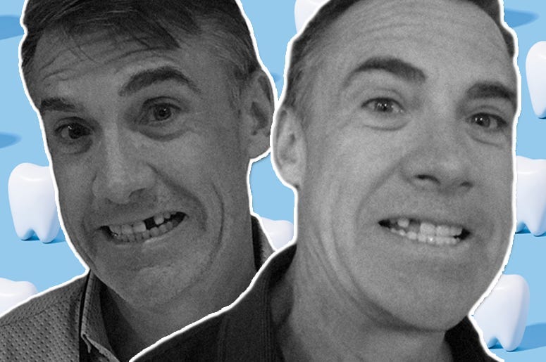 matt & ramona tooth loss